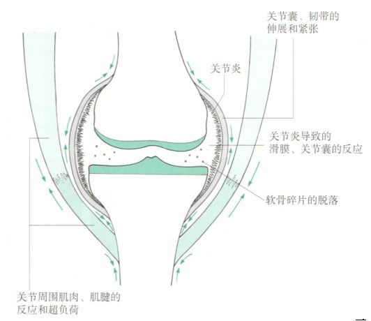 膝关节