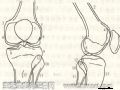 正常膝关节X线正侧位片的检查方法和表现症状